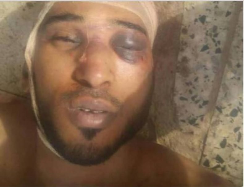 Yemen: rights radar calls on the un to urgently put an end to the killing of detainees and journalists