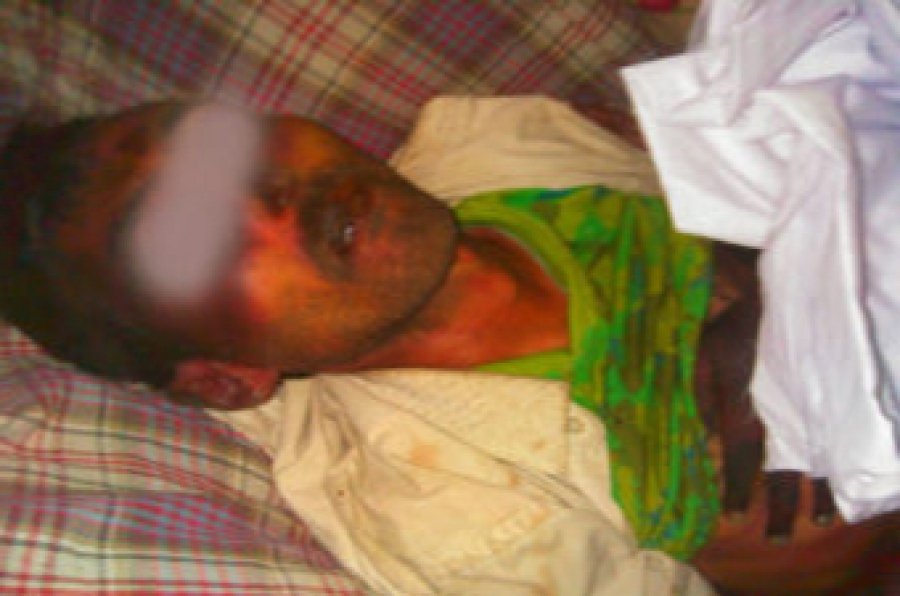 Yemen: 113 detainees killed under torture in houthi prisons