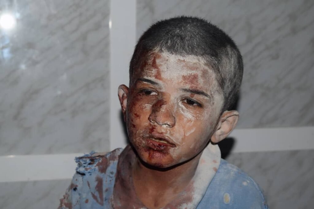 Rights Radar: 691 Civilians Deaths and 2,900 Injuries Due to Targeting Civilians by Houthis in Taiz